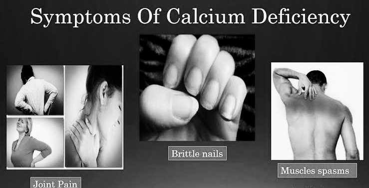 Calcium Deficiency: শরীরে ক্যালসিয়াম ঘাটতির লক্ষণ